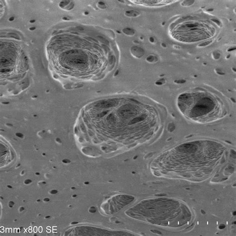 Outer surface of the dialyzer membrane. | Download Scientific Diagram