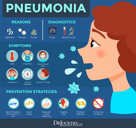 Pneumonia Causes Symptoms Support Strategies Material De