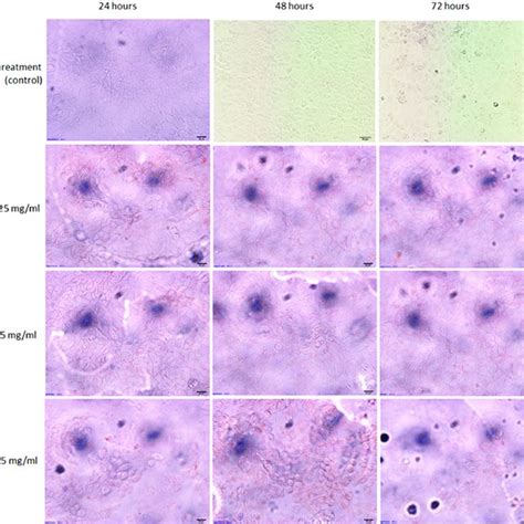 The morphology of Caco 2 cells after treatment with 1 25 5 mg ml À1