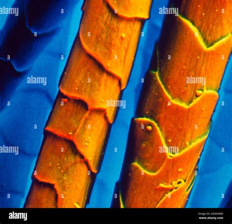 False Colour Scanning Electron Micrograph Sem Of Two Strands Of