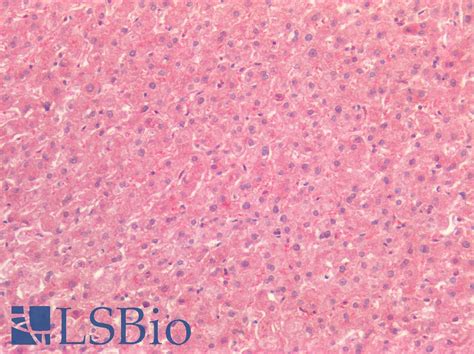 PathPlus TTR Transthyretin Polyclonal Antibody Rabbit IHC SWB LSBio