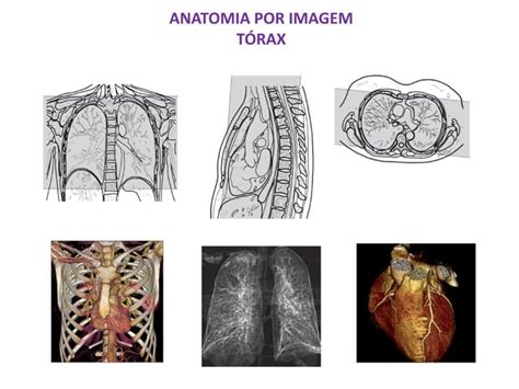 Anatomia Tórax Tc Rm Ppt