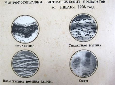 Embalming Techniques for Long-Term Preservation of Bodies - The Journal of Plastination