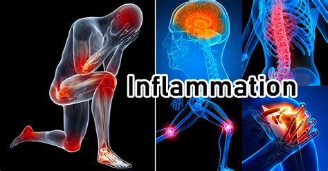 What Is Inflammation? 5 New Symptoms And Causes