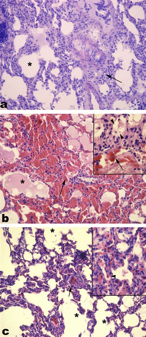 A Control Group Regular Morphology Of Lung Tissue With The Alveol Download Scientific