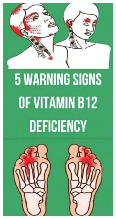 Vitamin B12 Deficiency Causes Hair Fall At Amy Villa Blog