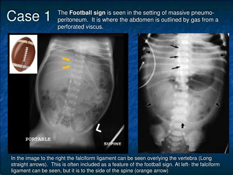 Ppt Abdominal Imaging Powerpoint Presentation Free Download Id2275884