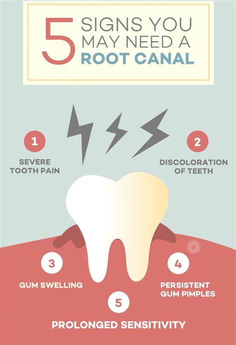 Root Canal Awareness Week Your Dentists In Asheville Nc