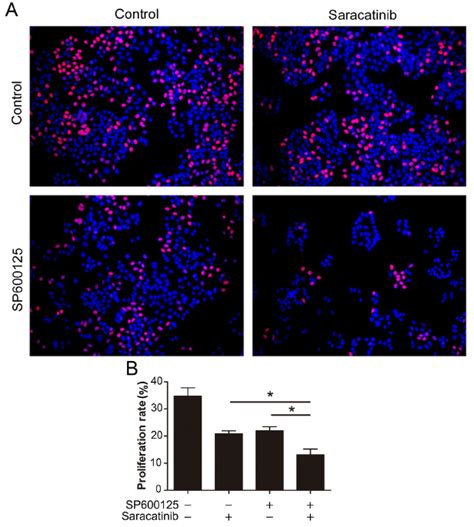 Combination Of Sp600125 And Saracatinib Synergistically Inhibits Hepg2