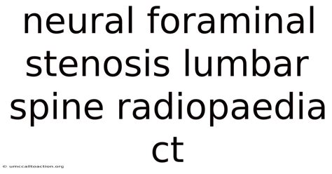 Neural Foraminal Stenosis Lumbar Spine Radiopaedia Ct