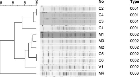 Pulsed Field Gel Electrophoresis Results Of A Baumannii Isolates That