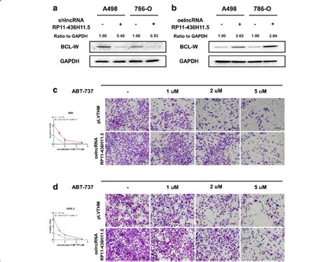 Lncrna Rp11 436h115 Enhances Rcc Cell Progression By Upregulating