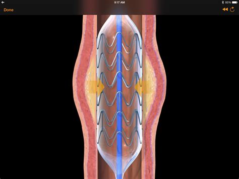 CardioSmart Explorer app review for iPad