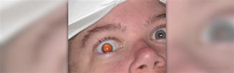 Disadvantages and risks of LASIK eye surgery | General center | SteadyHealth.com