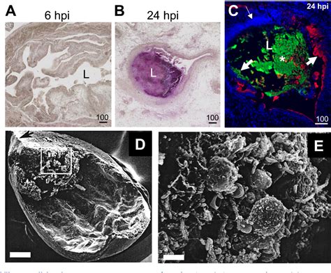 Pathogenesis Of Proteus Mirabilis Infection Semantic Scholar