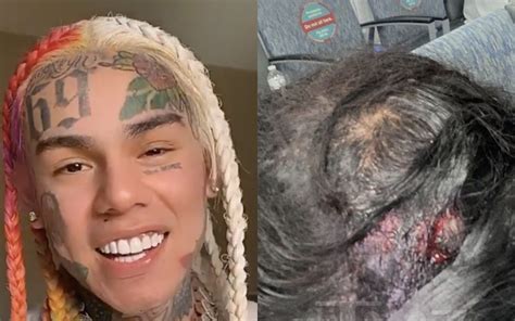 6ix9ine Sued By Miami Stripper For Champagne Bottle Injuries • Hollywood Unlocked