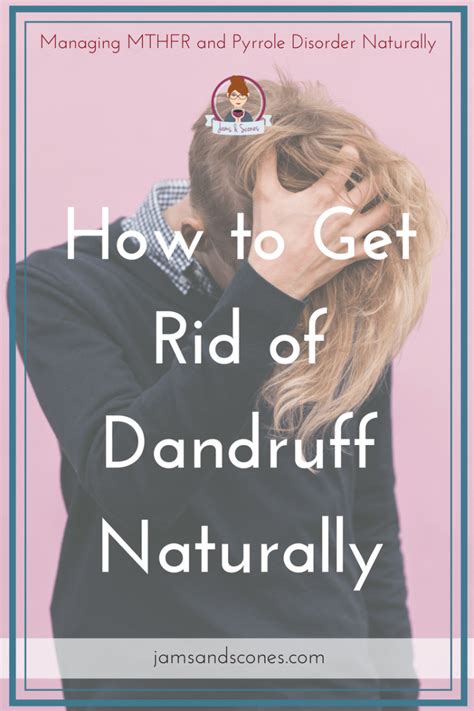 How To Get Rid Of Dandruff With These Home Remedies Get Rid Of