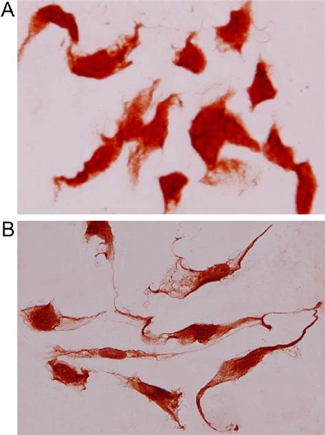 Immunohistochemical staining for α SMA and OPN in cultured stellate