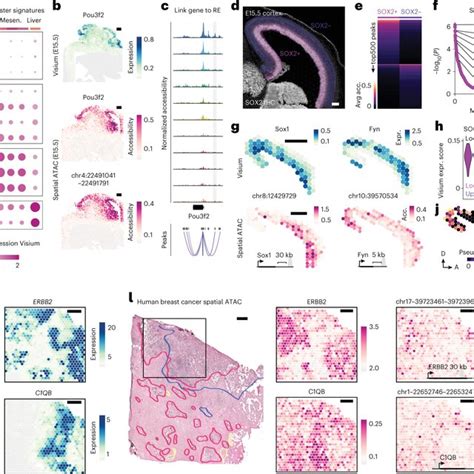 Workflow And Spatial Mapping Of Chromatin Accessibility In Mouse