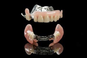 What Are Flexible Partial Dentures? - Sarasota Dentistry