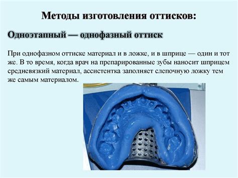 Оттискные материалы. Оттиски - презентация онлайн