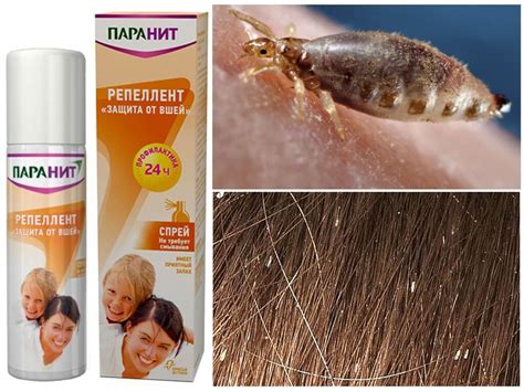 Народные средства от вшей и гнид: проверенные рецепты