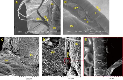 Scanning Electron Microscope Image Of The Superior Ovarian Nerve And Download Scientific