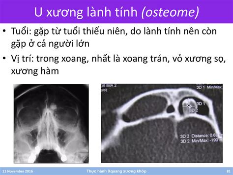 Thực hành X quang xương khớp | PDF