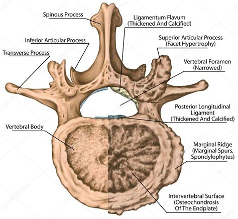 Second Lumbar Vertebra Lumbar Spine Vertebral Bone Vertebra