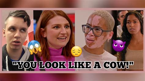 Mean Girls Shame Teens Skin Issues What Happens Next Is Shocking