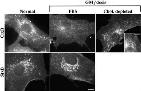 Internalization Of Fluorescent Ctxb And Stxb In Normal And Gm 1 Download Scientific Diagram