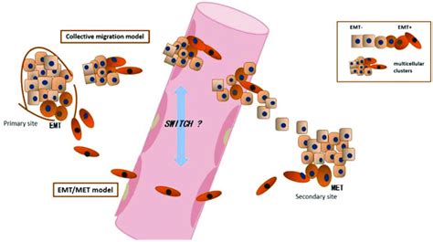 Emt And Metastatic Models Emt Met Model Epithelial Cancer Cells Must