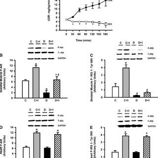 Dexamethasone Dex Effects On Whole Body And Tissue Specific Insulin