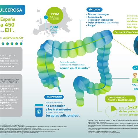 Infografía Colitis Ulcerosa Domestika