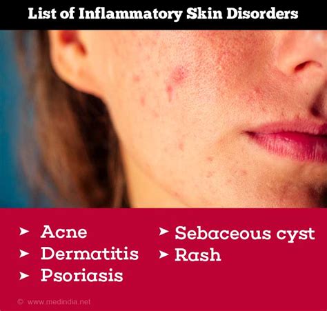 Skin Disease Dermatology Inflammatory Skin Disorders