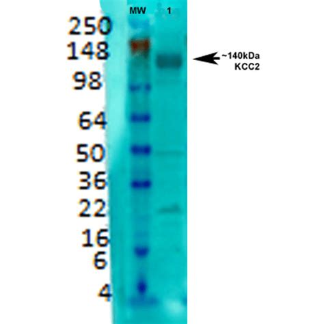 Anti K Cl Cotransporter KCC2 Antibody QED Bioscience Inc