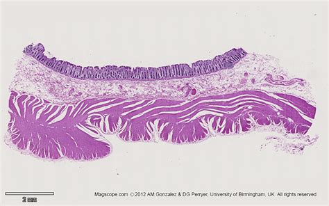 Colon Histology Slides Labeled