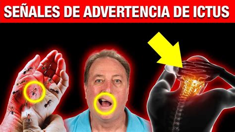 7 Síntomas de Accidente Cerebrovascular 1 mes antes de que ocurra