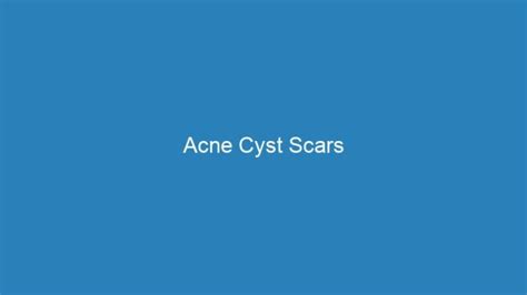 Acne Cyst Scars | Acne Complex Treatments