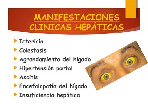 Enfermedades Hepaticas Ppt