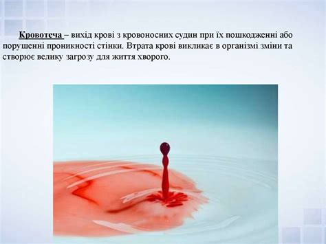 Види кровотеч. Алгоритм дій при кровотечі - презентация онлайн
