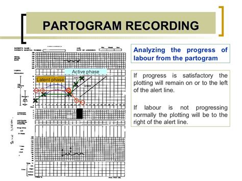 Partogram