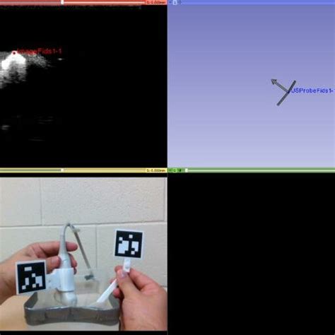 Selection of points during US calibration. Top left: stylus tip... | Download Scientific Diagram