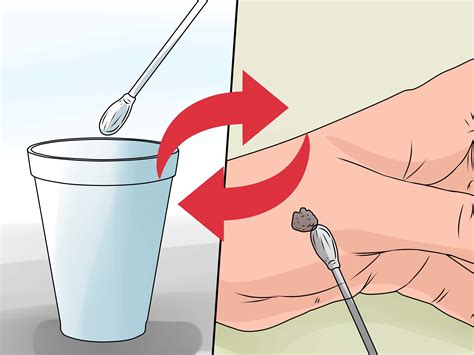 4 Ways to Freeze a Wart With Liquid Nitrogen - wikiHow