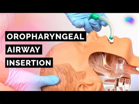 Oropharyngeal Airway Sizes