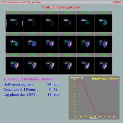 Nuclear Study: Gastric Emptying | Front Range Nuclear Services