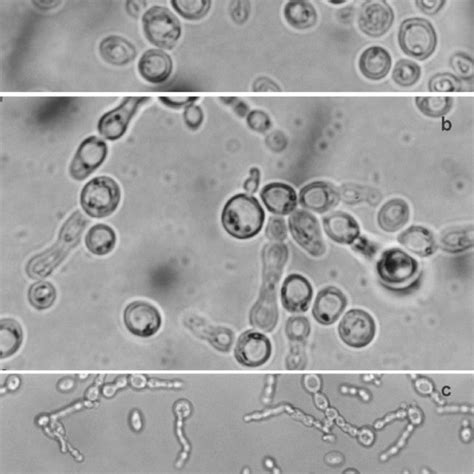 Pdf Hyphal Like Extension And Pseudohyphal Formation In Industrial