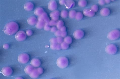 Streptococcus Agalactiae Streptococcus Grupo B