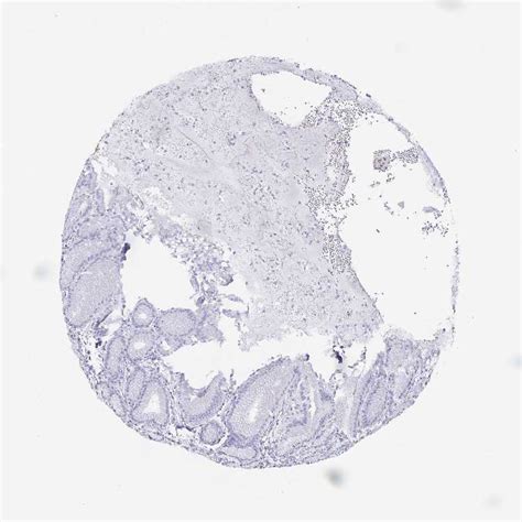 Tissue Expression Of Chga Staining In Stomach The Human Protein Atlas