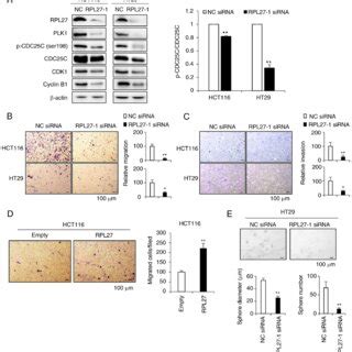 RPL27 silencing disrupts PLK1 signaling and inhibits CRC cell migration ... 